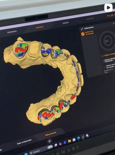 Planejamento digital de tratamento odontológico